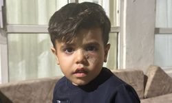 Maganda Kurşunu Şanlıurfa’da Küçük Çocuğu Hedef Aldı