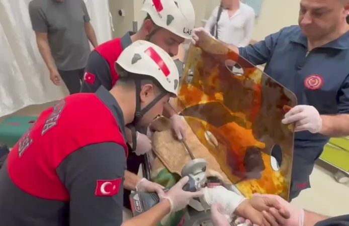 Koluna demir şiş saplanan vatandaş o şekilde ameliyata alındı