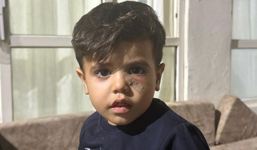 Maganda Kurşunu Şanlıurfa’da Küçük Çocuğu Hedef Aldı